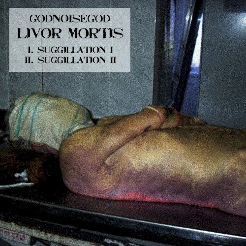 Livor Mortis