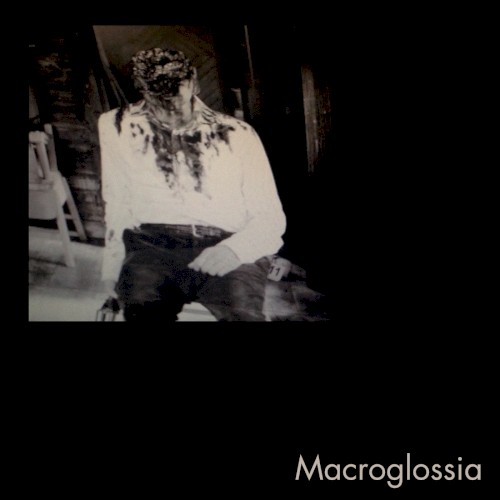 Macroglossia