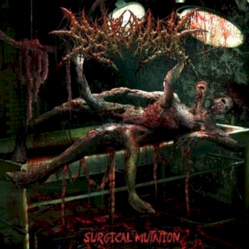 Surgical Mutation