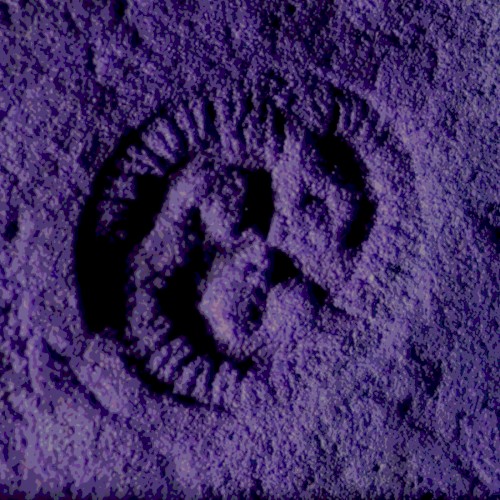 Trilobozoa