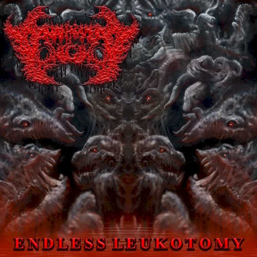 Endless Leukotomy