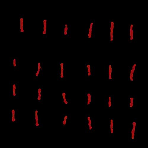 Strokes of Incarceration