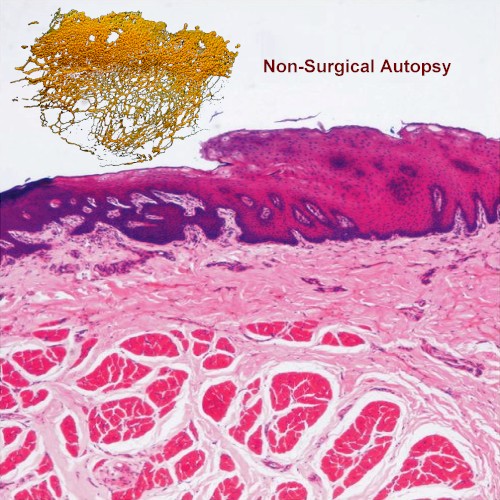 Non-Surgical Autopsy