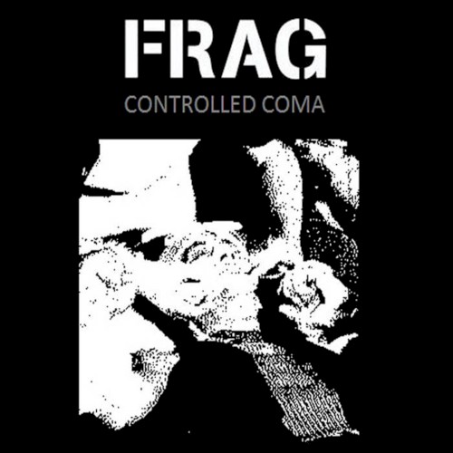 Controlled Coma