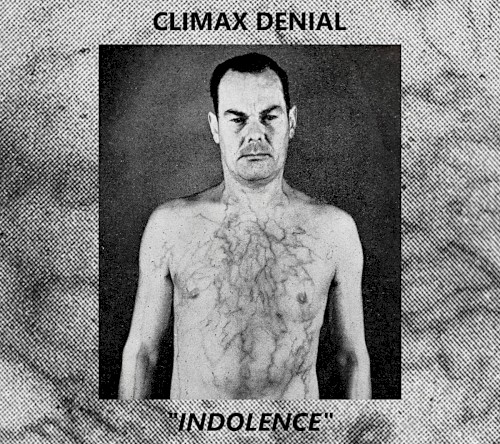 Indolence