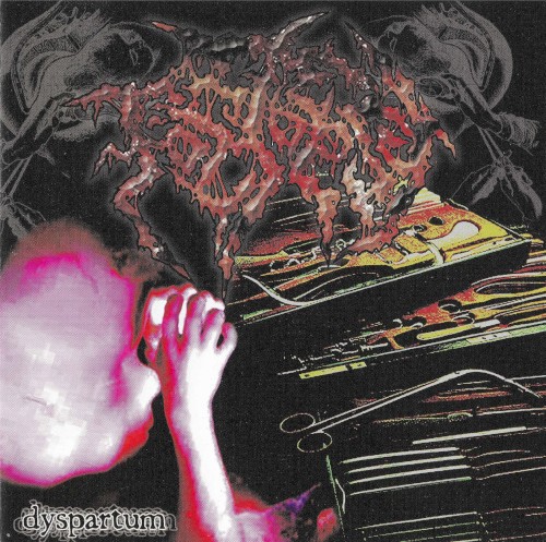 Dyspartum