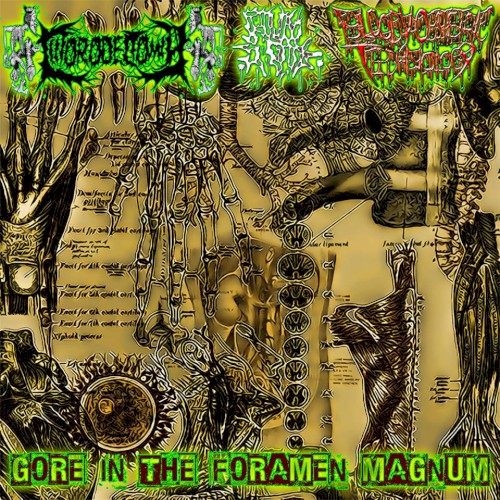 Gore In the Foramen Magnum