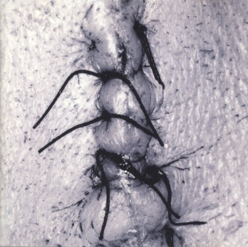 Infliction