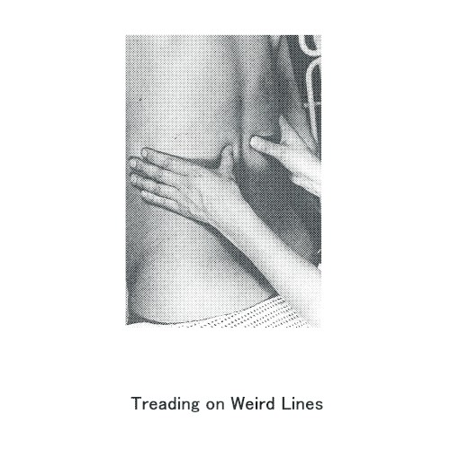 Treading on Weird Lines