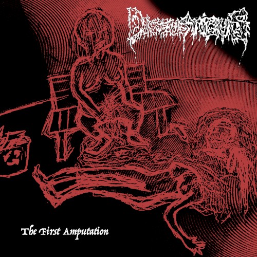 The First Amputation
