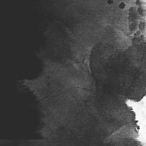 Surface