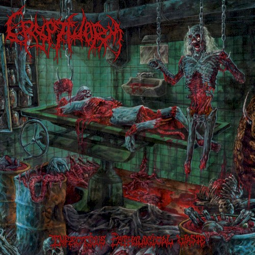 Infectious Pathological Waste