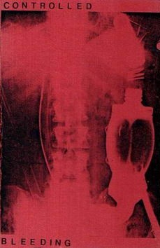 Controlled Bleeding