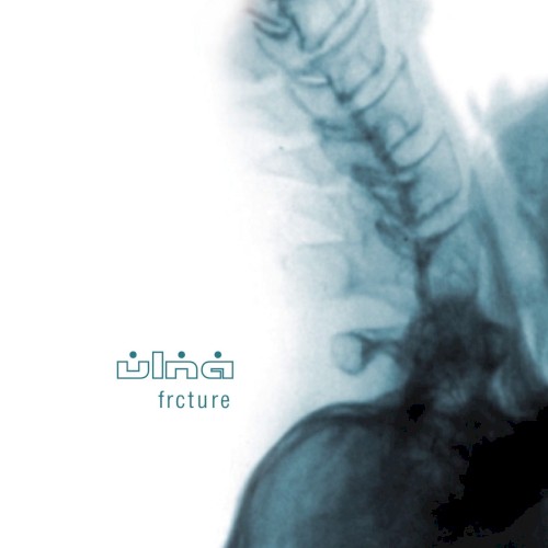 Frcture