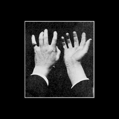 III