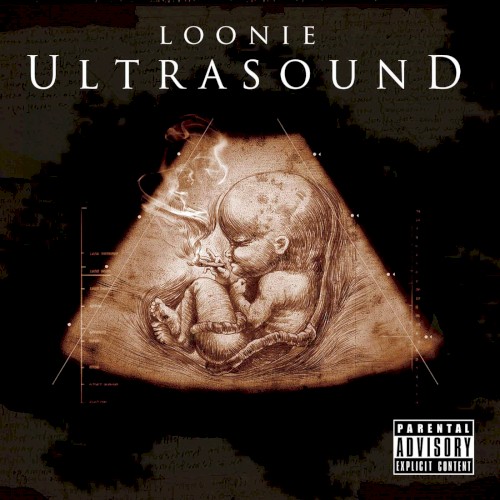 Ultrasound