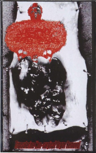 Transuterine Non-Surgical Organ Removal