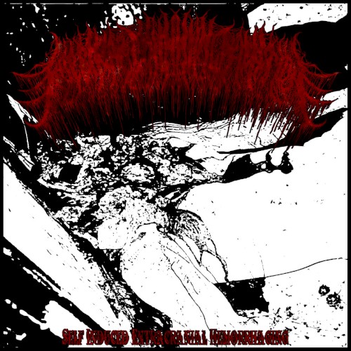 Self Induced Extracranial Hemorrhaging