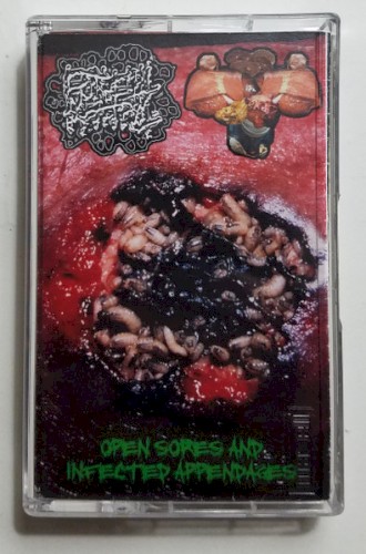 Open Sores And Infected Appendages