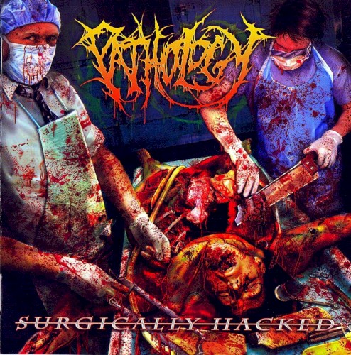 Surgically Hacked
