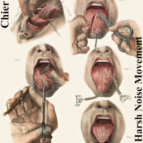 Ankyloglossia