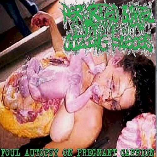 Foul Autopsy on Pregnant Carrion