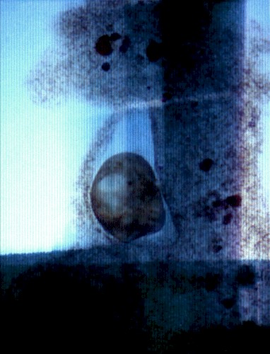 Refrattario