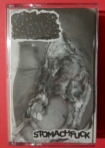Cadaversludge / Stomachfuck