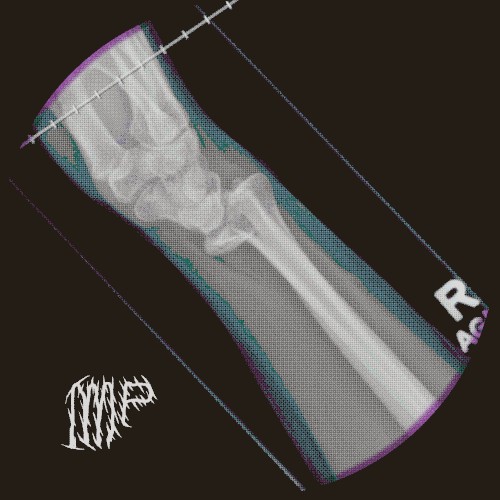 Fractured
