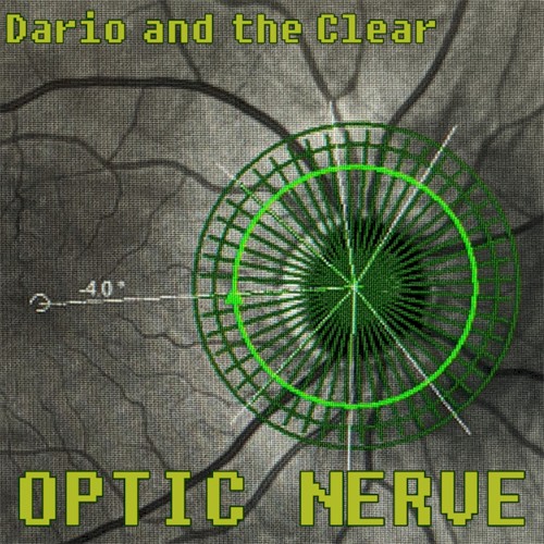 Optic Nerve