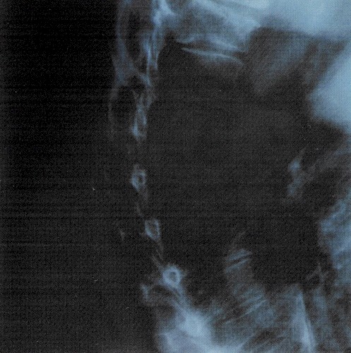 Ea II