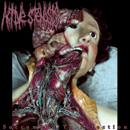 Succumbed to Infection
