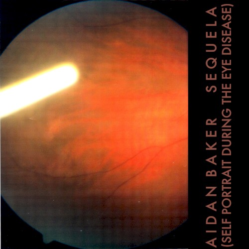 Sequela (Self Portrait During the Eye Disease)