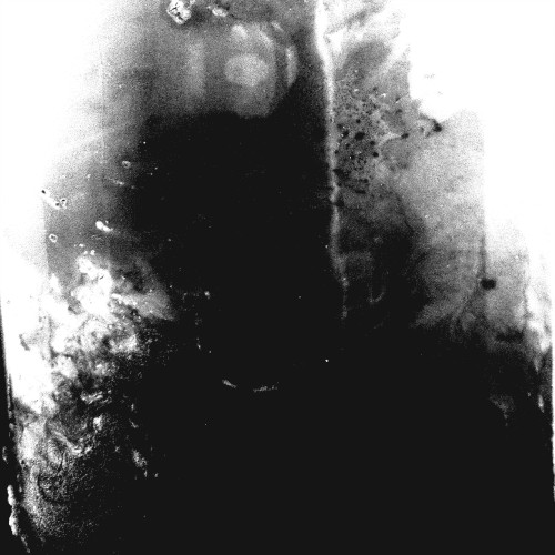 Benzalkonium I/II